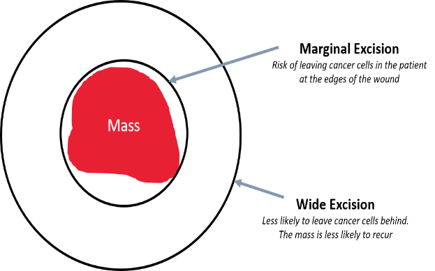 This diagram shows intended 3 cm margins to remove a soft tissue sarcoma. Without these margins, the cancer will reoccur. It is important for the surgeon to take a layer of tissue deep to the cancer as well, in order to be sure to not leave any cancer cells in the patient